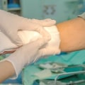 Understanding Wound Care and Dressing Changes at Home